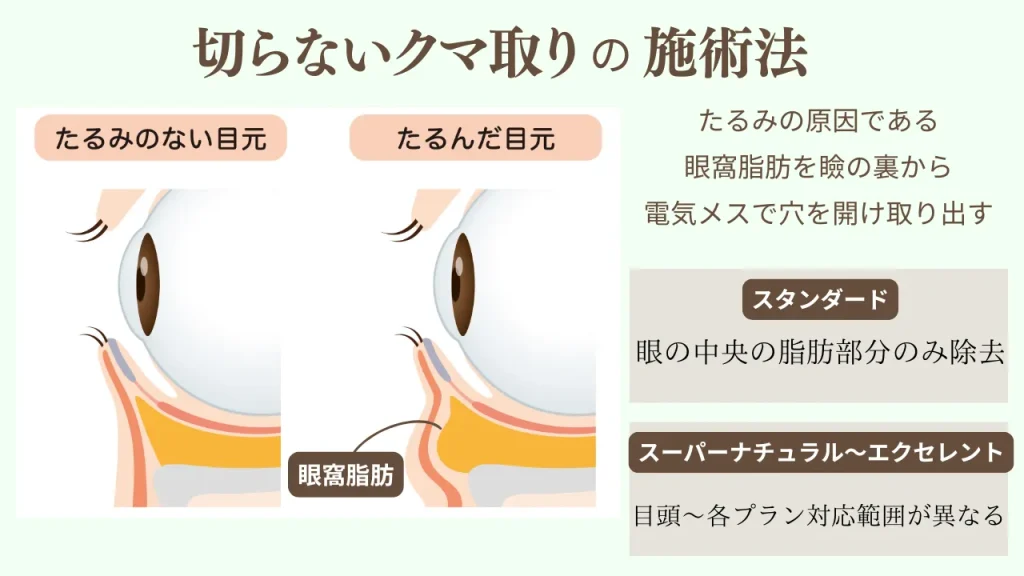 切らないクマ取りの施術説明
