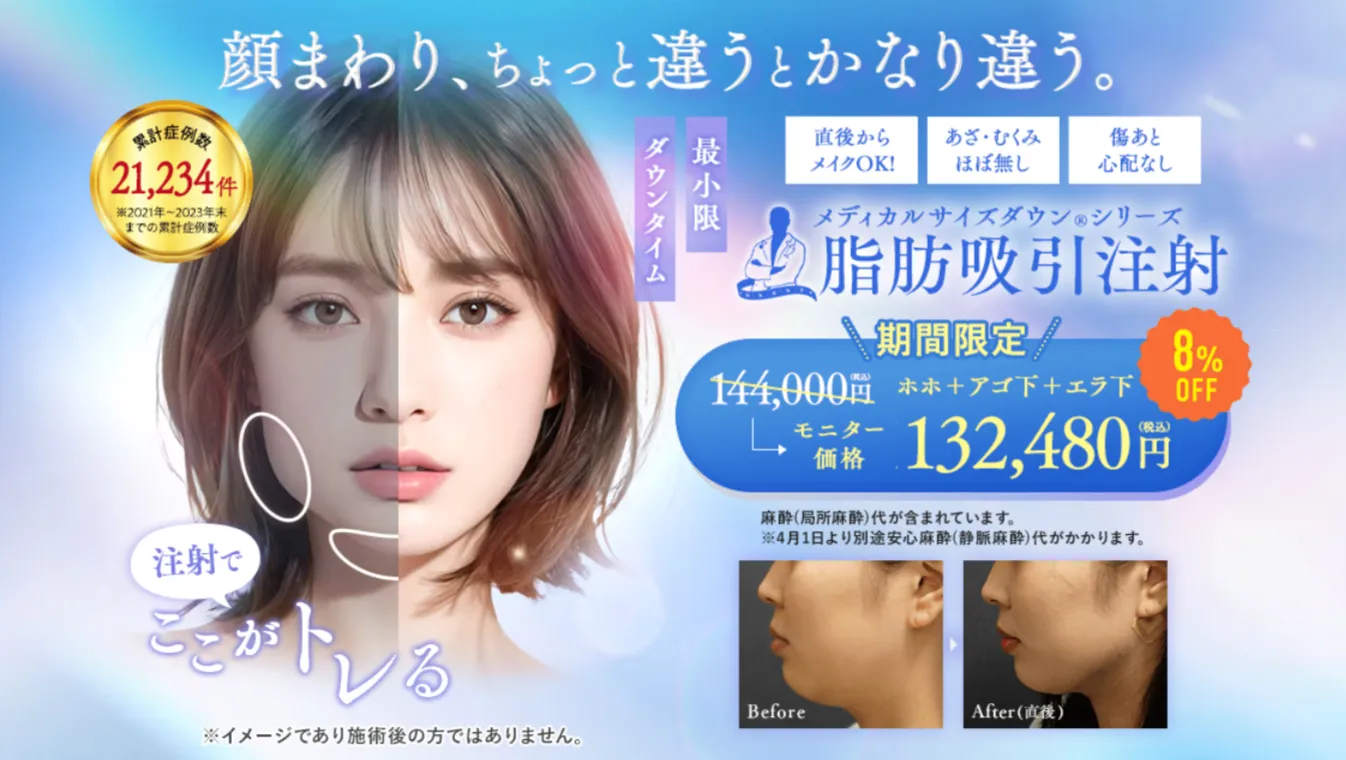 湘南美容クリニック 脂肪吸引注射