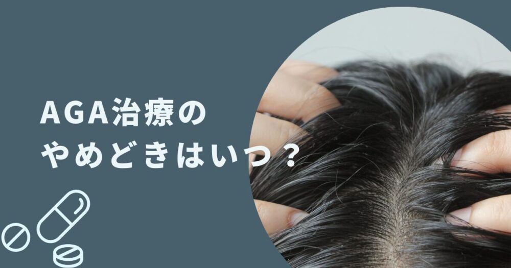AGA治療のやめどきはいつ？自己判断する前に知っておくべき5つのポイント