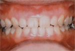 矯正歯科の説明へ